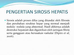 Maybe you would like to learn more about one of these? Sirosis Hepatis Hendi Gunawan Ppt Download