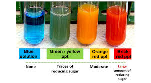 Benedicts Test Principle Preparation Procedure And