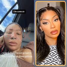 Tommie Lee shares her painful experience after being administered  penicillin, which she’s allergic to. 👀