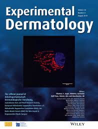 + they have gels with varying hold. Optimization Of Reference Gene Panels For Gene Expression Analysis In Preclinical Models Of Inflammatory Skin Diseases Braun 2019 Experimental Dermatology Wiley Online Library