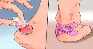 Ampulla (botella), es un mecanismo de defensa del cuerpo humano consistente en una lesión elevada (inflamación), palpable y circunscrita, llena de líquido linfático y otros fluidos corporales, que se forma en la epidermis. Ampollas Y Unas Negras Por Correr Aprende A Eliminarlas Marathon Ranking