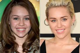 Star rifatte under 30: quando la chirurgia non ha età