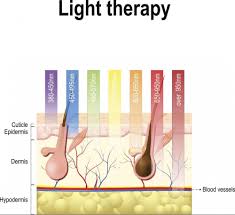 Androgenetic alopecia, the most common type, affects 50% of males over the age of 40 and 75% of females over 65. The Truth About Red Light Therapy For Hair Growth Infrared For Health