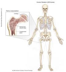 Bone marrow is the soft, highly vascular and flexible connective tissue within bone cavities which serve as the primary site of new blood cell production or bone marrow is the primary source of pluripotent stem cells that give rise to all hemopoietic cells (blood cells) including lymphocytes. Bone Cancer Sarcoma Of Bone Medical Illustrations Cancer Net