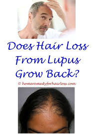 Pin On Hair Loss