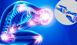 Su origen es autoinmunitario y es la causa más frecuente de parálisis generalizada aguda o subaguda. Autoanticuerpos En El Sindrome De Guillain Barre Dr Christian La Rosa