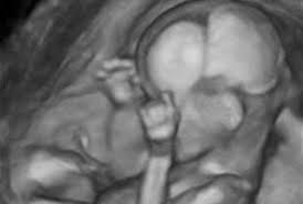 hafta hafta gebelik gelisimi 15 haftalik gebelik donemi canbebe blog