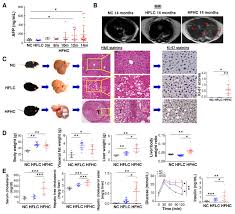 Dietary Cholesterol Drives Fatty Liver Associated Liver Cancer By Modulating Gut Microbiota And Metabolites Gut