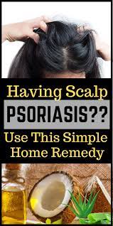 Home Remedies To Treat Scalp Psoriasis Scalpcare Itchyness Homeremedies Dandruff Haircare Natural Healing Remedies Scalp Psoriasis Remedies