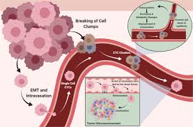 Check spelling or type a new query. Molecular Principles Of Metastasis A Hallmark Of Cancer Revisited Signal Transduction And Targeted Therapy