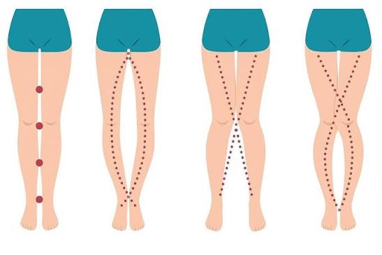 A WOMAN'S LEGS CAN TELL HOW HER IS