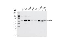 This page is about the various possible meanings of the acronym, abbreviation, shorthand or slang term: Srf D71a9 Xp Rabbit Mab Cell Signaling Technology