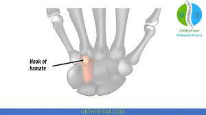 Image result for Hamate Bone