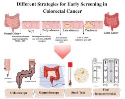 Image result for Colorectal Cancer Screening