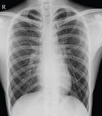 Image result for Chest Pain Observation Unit