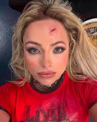 Prayers up for WWE RAW star Liv Morgan. Read Here https://rb.gy/zou839