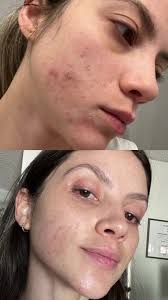 Serumkind Serum Review