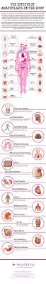 15 Effects Of Anaphylaxis On The Body Asthma Treatment Anaphylaxis Food Allergies Awareness
