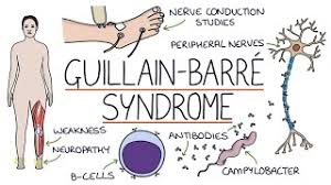 Understanding Guillain Barre Syndrome Youtube