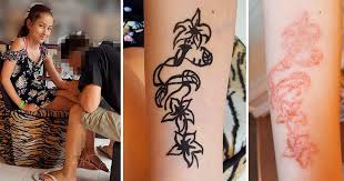 You got a henna tattoo that said forever. Black Henna Tattoo Chemical Burns Girl On Vacation
