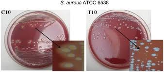 Size, haemolysis and pigmentation of colonies of S. aureus ATCC 6538... |  Download Scientific Diagram