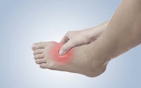 Complex Regional Pain Syndrome A Gateway Diagnosis Paradigm