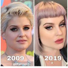 Jessica Manges ARNP Aesthetic