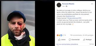 Deux ans après les faits, le gilet jaune blessé à la tête par un tir de lbd raconte figure emblématique du mouvement des gilets jaunes, jérôme rodrigues avait perdu son œil peu de gilets jaunes, et pas de cortège, mais les militants de france palestine s'efforcent de. Ces Gilets Jaunes Gravement Blesses Par La Police Dont Les Medias Ne Parlent Pas