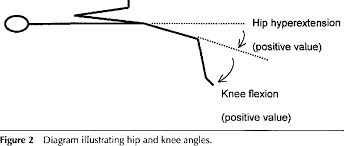 Image result for Thomas Test