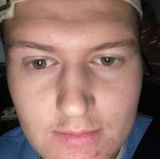 👨🏻MOVEMBER UPDATE👨🏻