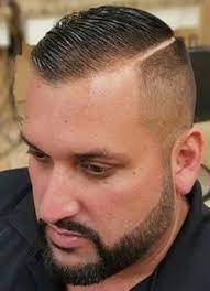 Pin On Balding And Hair Loss