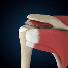 Image result for Rotator Cuff Injury
