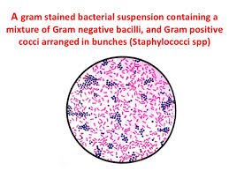 It has abundant transporter systems to adapt to ever changing ph, osmolarity, and concentration of urea in human urine. What Are Some Examples Of Gram Negative Bacteria Socratic