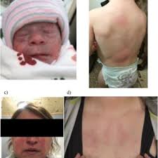 Anne Junker's research works