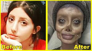 Actress angelina jolie announced today that she underwent a preventative double mastectomy after learning she is at a high risk of developing breast cancer. Sahar Tabar S Zombie Angelina Jolie Photos Know Your Meme