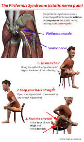 Pin On Sciatic Nerve Stretches