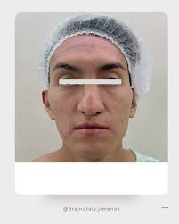 Nataly Jiménez Cirujana