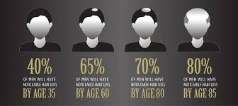 Fphl is a progressive condition. Why Is My Hair Thinning Signs Of Balding In Your 20 S 30 S