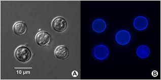 Image result for Cyclospora