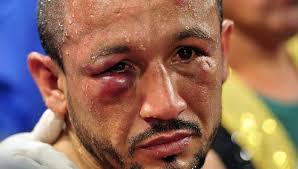 Boxing at the Garden