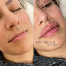 BETH MELVILLE AESTHETICS (@bethmelville_aesthetics) • Instagram photos and  videos