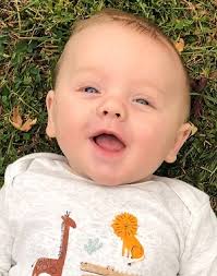 Image result for Hydrocephalus