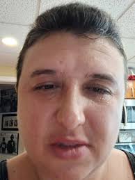 onion trick for shaving