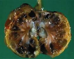 Side Effects Of Drinking Diet Soda Re Pinned Health Food Diet Soda Health And Nutrition