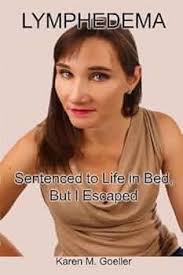 Lymphedema: Sentenced to Life in Bed, But I Escaped by Karen M Goeller  (2011-11-01): Karen M. Goeller: Amazon.com: Books