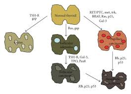But most dna mutations linked to breast cancer are acquired. Figure 2 Clinical And Pathological Implications Of Concurrent Autoimmune Thyroid Disorders And Papillary Thyroid Cancer