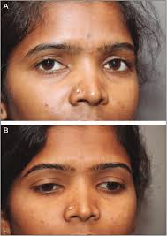 Image result for forehead tattoo