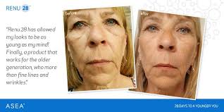 Check out a few of the latest Do You Renu success stories! Visit:  http://doyourenu.com/SEE-THE-RESULTS for more great before and after  stories!