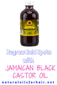 How To Regrow Bald Spots With Jamaican Black Castor Oil Jamaican Black Castor Oil Black Castor Oil Bald Spot