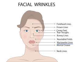 The reason lemon juice is an amazing way to help you get rid of the marionette lines is because of the acid in it. Marionette Lines Expert Treatment In Central London